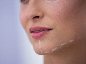 فیلر چانه | فیلر | ژل | تزریق فیلر | دکتر حمیدرضا رهبر | پزشک زیبایی هشتگرد | دکتر پوست و مو هشتگرد | تهران