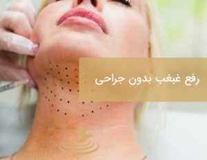 رفع غبغب | مزوتراپی بدون جراحی | دکتر حمیدرضا رهبر | پزشک زیبایی هشتگرد | دکتر پوست و مو هشتگرد | تهران