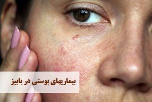 بیماریهای پوستی در پاییز | دکتر حمیدرضا رهبر | هشتگرد | تهران | بهترین دکتر پوست و مو هشتگرد تهران