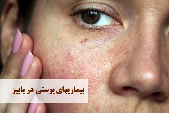 بیماریهای پوستی در پاییز | دکتر حمیدرضا رهبر | هشتگرد | تهران | بهترین دکتر پوست و مو هشتگرد تهران
