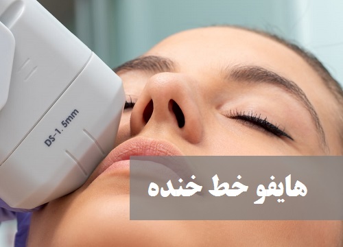 هایفو خط خنده | هایفوتراپی خط خنده | دکتر حمیدرضا رهبر