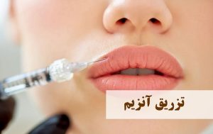 آنزیم