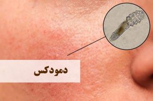 درمان دمودکس | دکتر حمیدرضا رهبر | هشتگرد | تهران