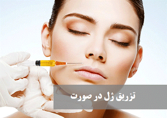 تزریق ژل در صورت | دکتر حمیدرضا رهبر