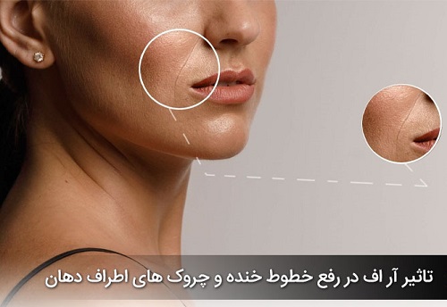 آر اف هشتگرد دکتر رهبر